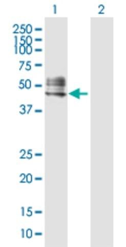 Anti-RTN4R antibody produced in rabbit