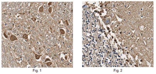 Anti-S100B Antibody