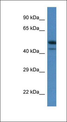 Anti-SBK1 antibody produced in rabbit