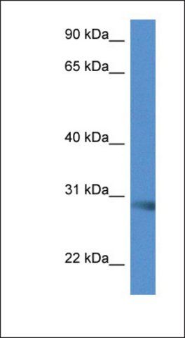 Anti-SCAMP5 antibody produced in rabbit