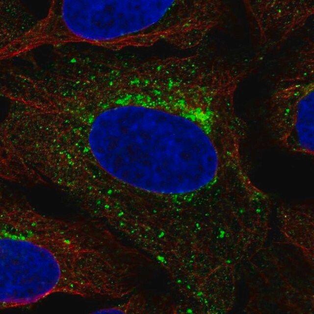 Anti-SCAMP3 antibody produced in rabbit