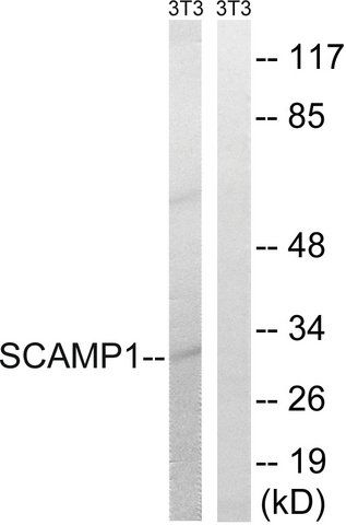 Anti-SCAMP1 antibody produced in rabbit