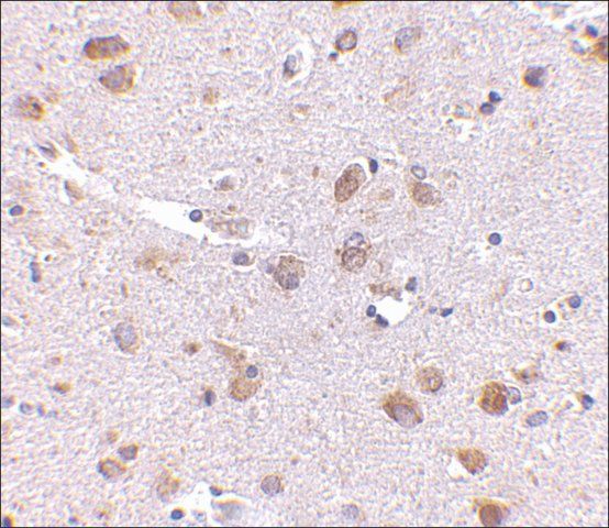 Anti-SATB1 (ab1) antibody produced in rabbit