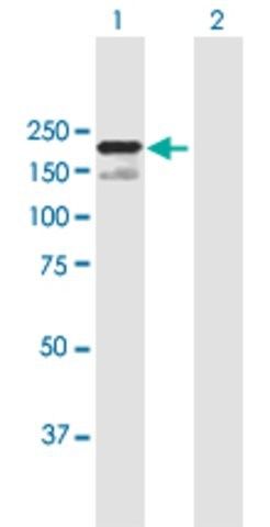 ANTI-SCAPER antibody produced in mouse