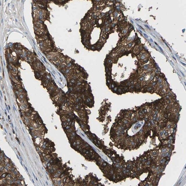 Anti-SCAMP2 antibody produced in rabbit