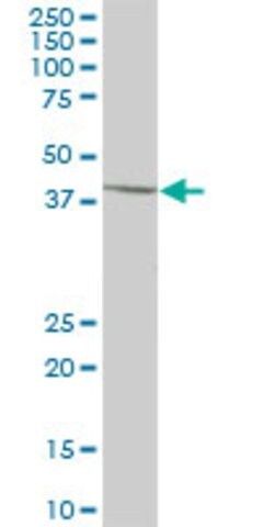 Anti-SCCPDH antibody produced in mouse