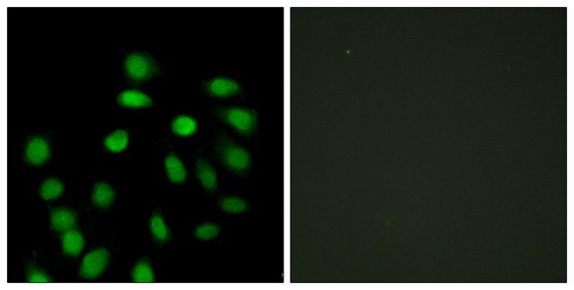 Anti-SCAND1 antibody produced in rabbit