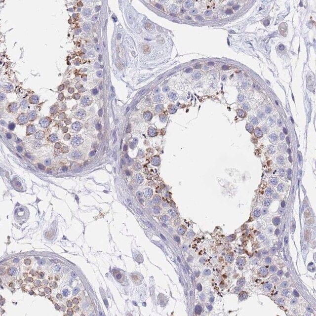 Anti-SCCPDH antibody produced in rabbit