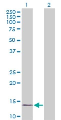 Anti-RPLP1 antibody produced in mouse