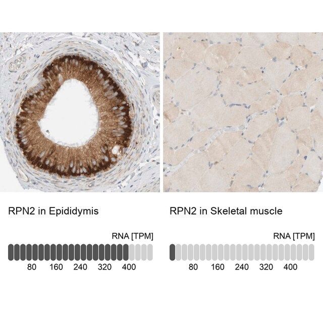 Anti-RPN2 antibody produced in rabbit