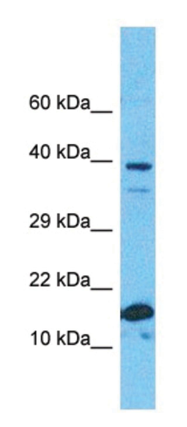 Anti-RPS19 (C-terminal) antibody produced in rabbit