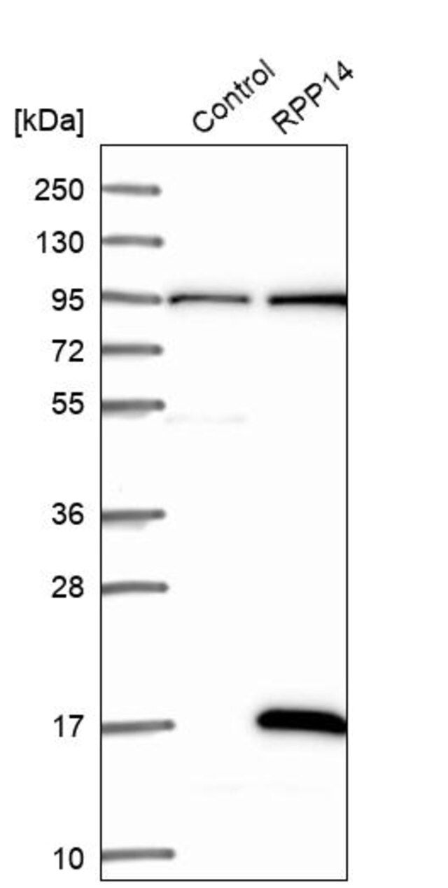 Anti-RPP14 antibody produced in rabbit