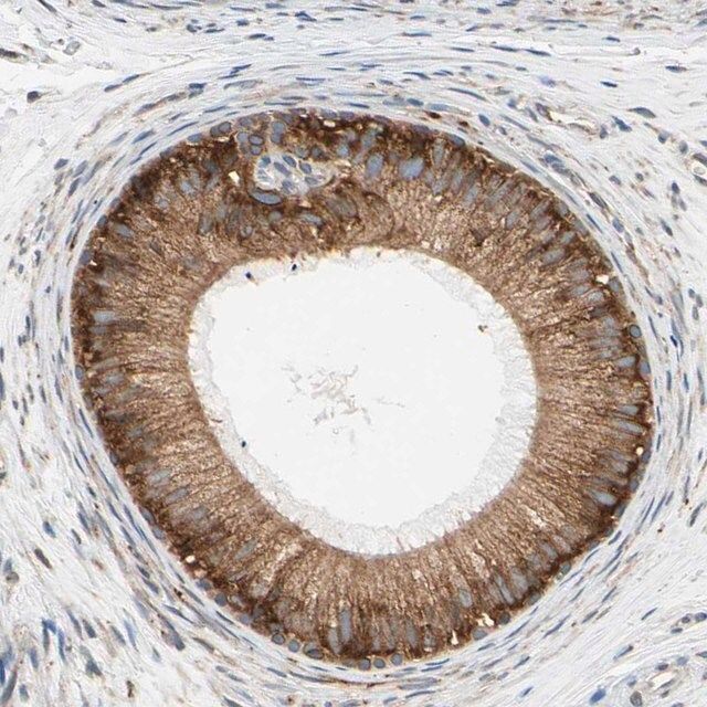 Anti-RPN2 antibody produced in rabbit