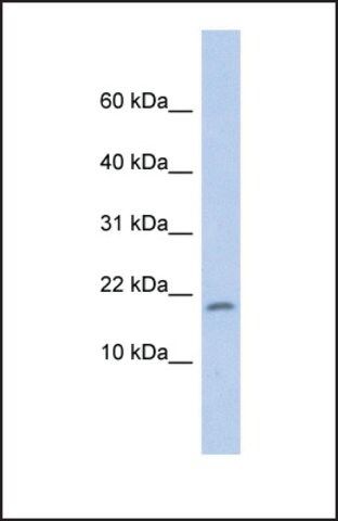 Anti-RPS15 antibody produced in rabbit