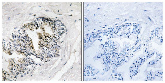 Anti-RPLP2 antibody produced in rabbit