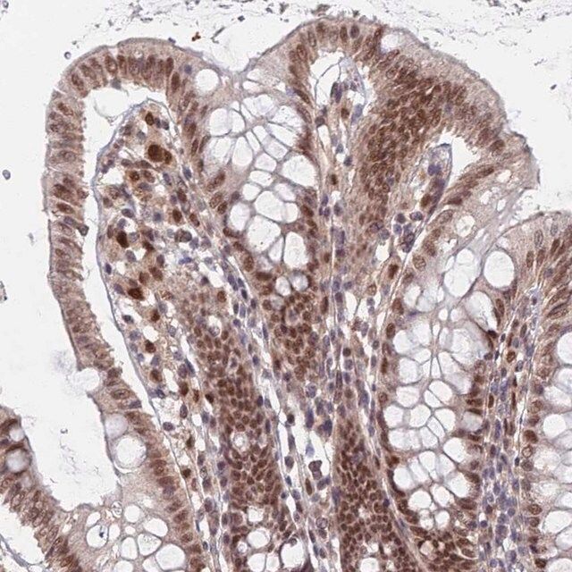 Anti-RPP25 antibody produced in rabbit