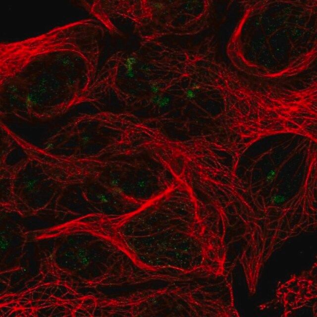 Anti-RPL7L1 antibody produced in rabbit