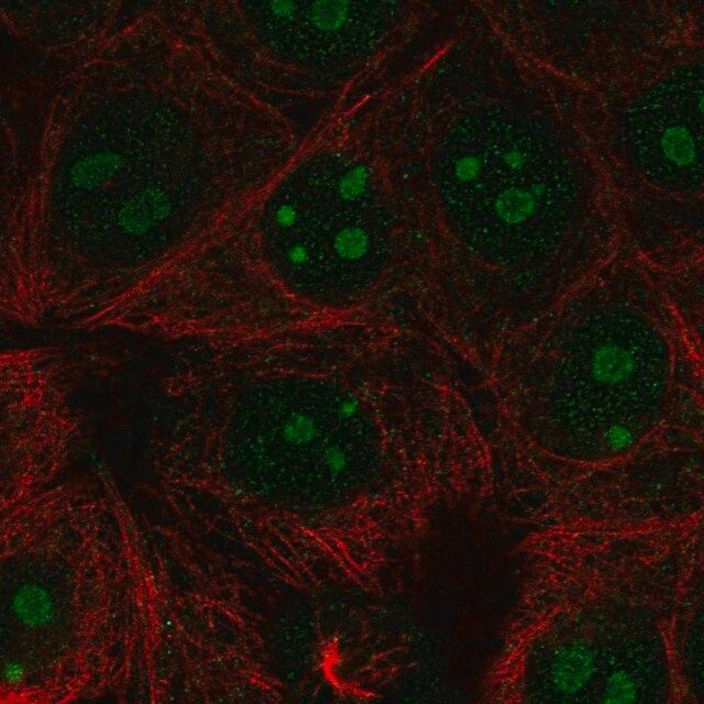 Anti-RPL22L1 antibody produced in rabbit