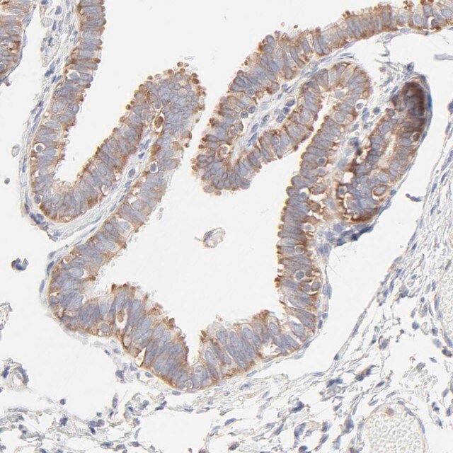 Anti-RPS21 antibody produced in rabbit