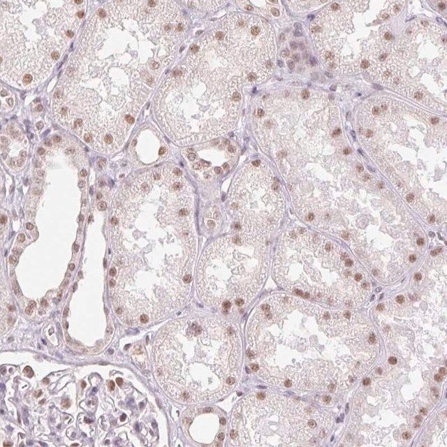 Anti-RPRD1B antibody produced in rabbit