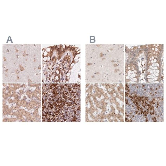 Anti-RPN1 antibody produced in rabbit