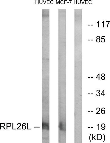 Anti-RPL26L antibody produced in rabbit