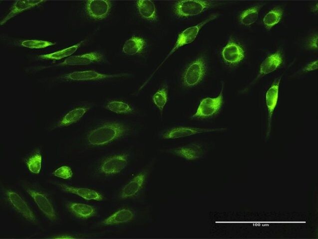 Anti-RPN2 antibody produced in rabbit