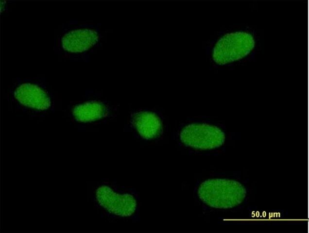 Anti-RPP40 antibody produced in mouse