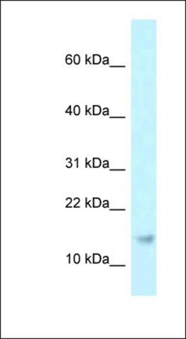 Anti-RPP21 antibody produced in rabbit