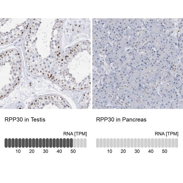 Anti-RPP30 antibody produced in rabbit