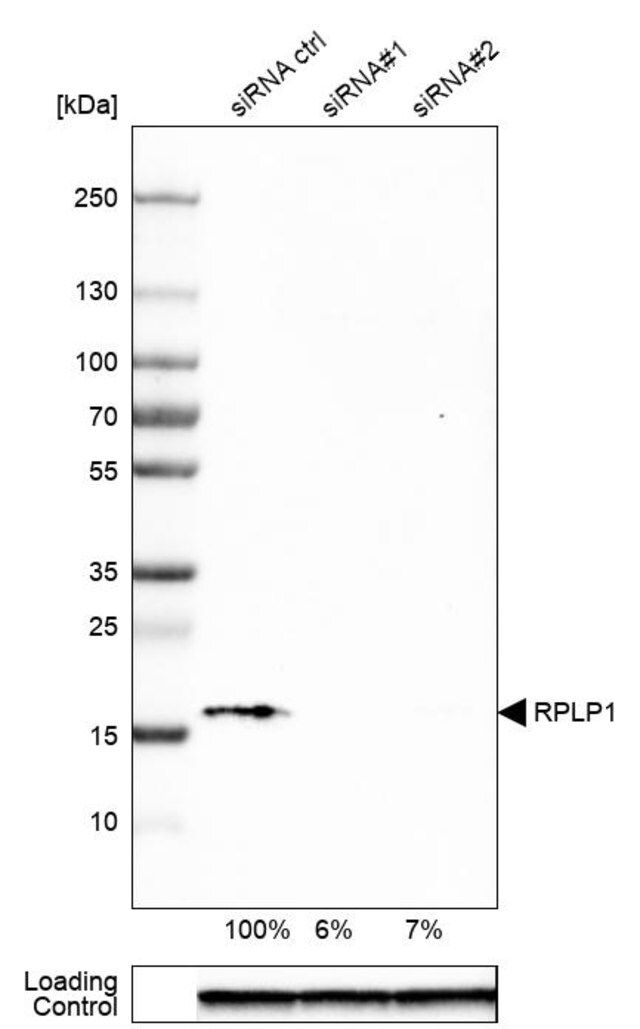 Anti-RPLP1 antibody produced in rabbit