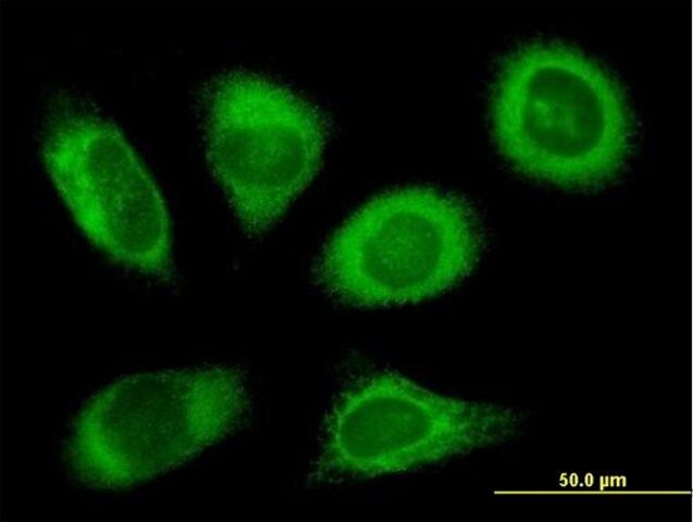 Anti-RPN2 antibody produced in mouse