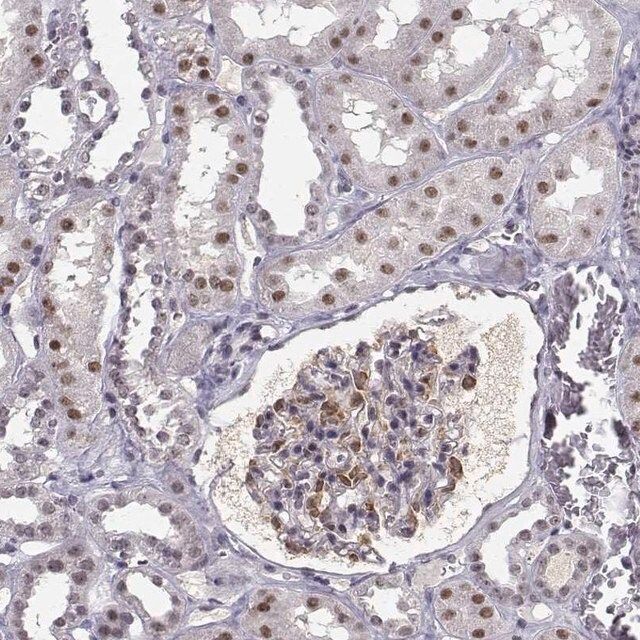 Anti-RPP38 antibody produced in rabbit