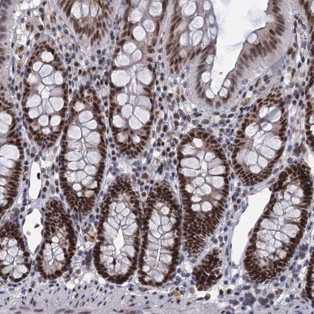 Anti-RPRD1A antibody produced in rabbit