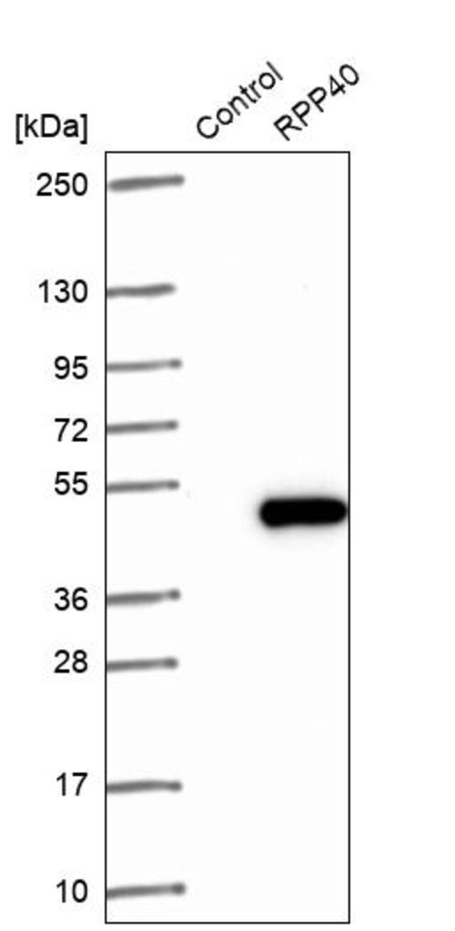 Anti-RPP40 antibody produced in rabbit