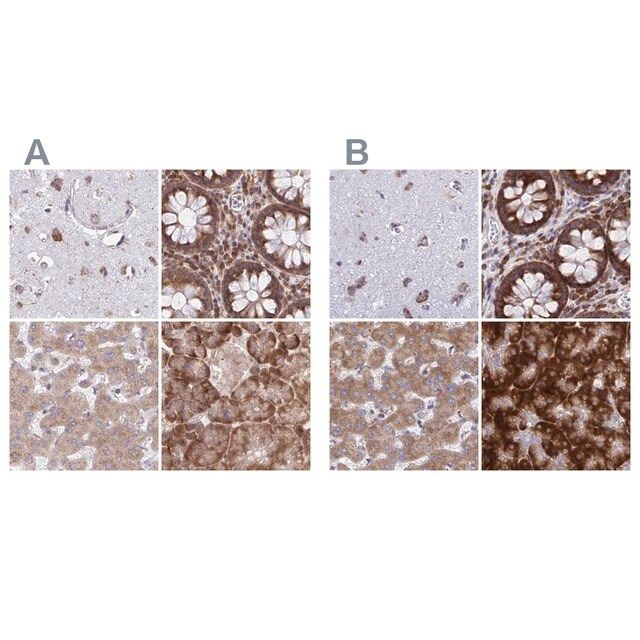 Anti-RPS15 antibody produced in rabbit