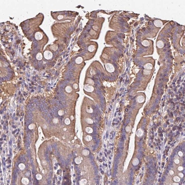 Anti-RPRML antibody produced in rabbit