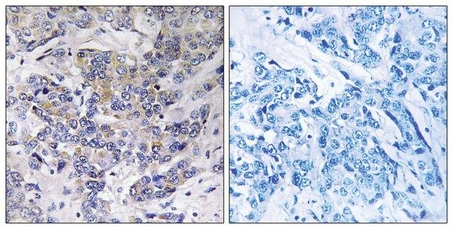 Anti-RPS21 antibody produced in rabbit