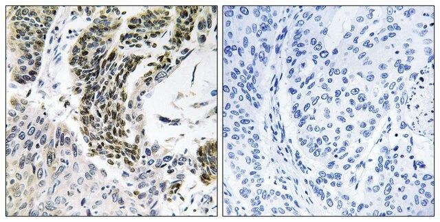 Anti-RREB1 antibody produced in rabbit