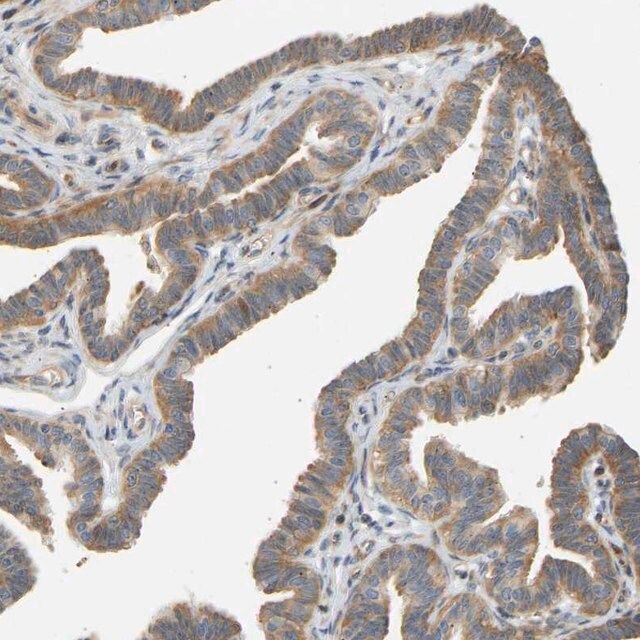 Anti-RPS14 antibody produced in rabbit