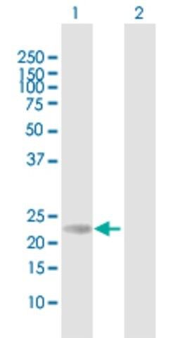 Anti-RS1 antibody produced in mouse