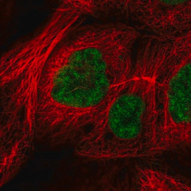 Anti-RSRC2 antibody produced in rabbit