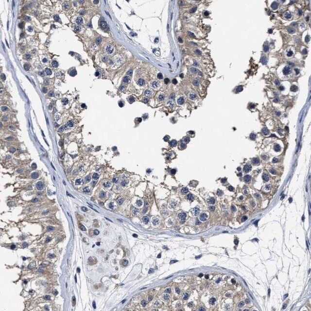 Anti-RSBN1L antibody produced in rabbit