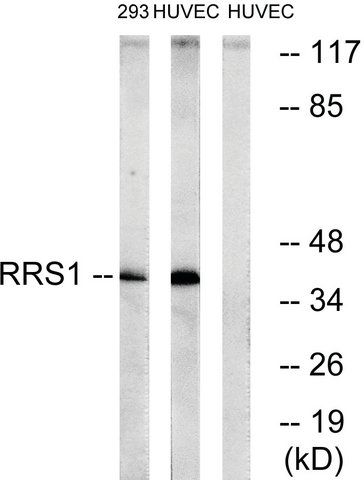 Anti-RRS1 antibody produced in rabbit