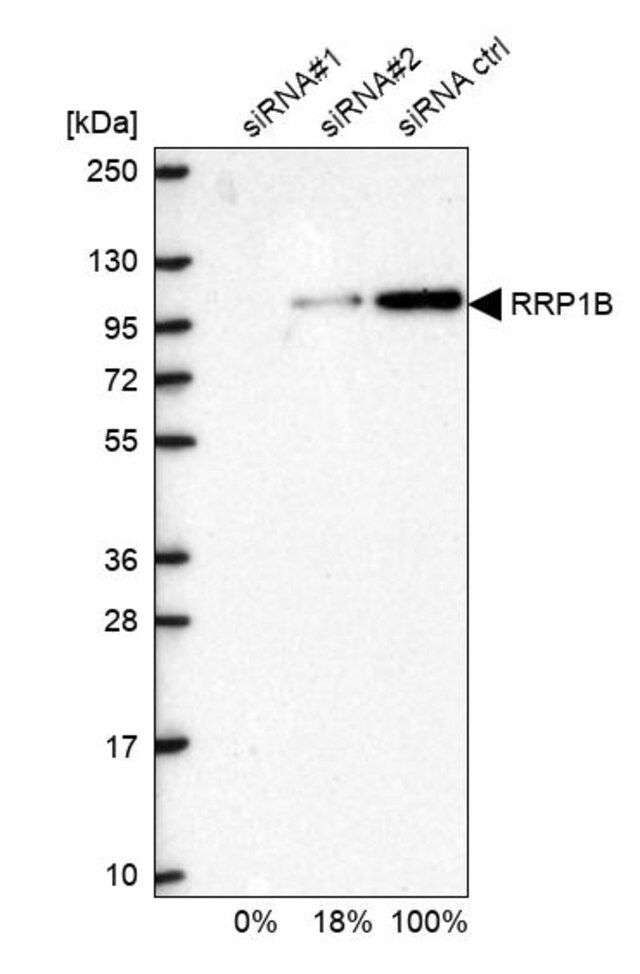 Anti-RRP1B antibody produced in rabbit