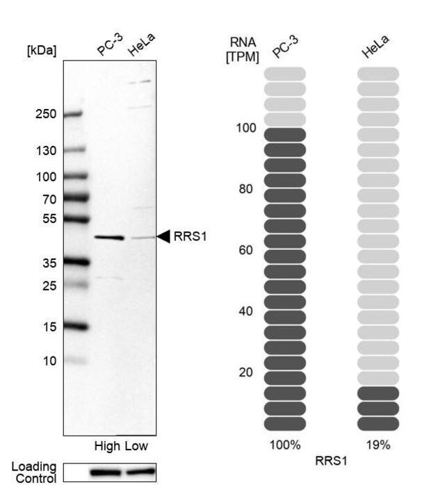 Anti-RRS1 antibody produced in rabbit