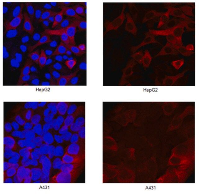 Anti-RRM2 Antibody, clone 4D1.2