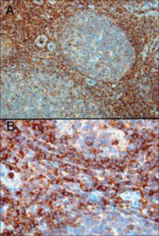 Anti-RAC2 antibody produced in goat