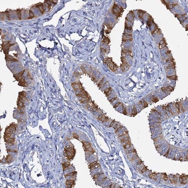 Anti-RABL2A antibody produced in rabbit