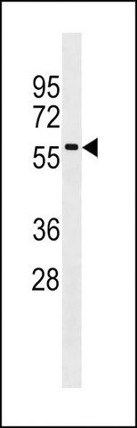 ANTI-RAB9P40(C-TERMINAL) antibody produced in rabbit